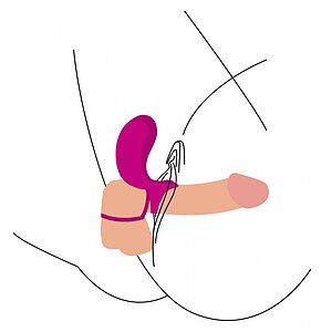 Inel Dublă Stimulare Couples Stimulator Ring Fuchsia Thumb 5
