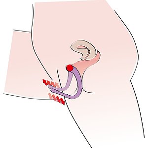 Genital Spreader Punctul G Mov Thumb 3